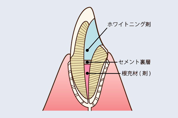 綺麗に死ぬ方法 絨毯やラグを洗わずに、綺麗にお手入れする方法